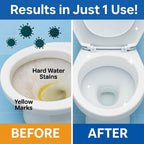 GermMukt™ All in 1 Toilet Cleaning Spray | BUY 1 GET 1 FREE!